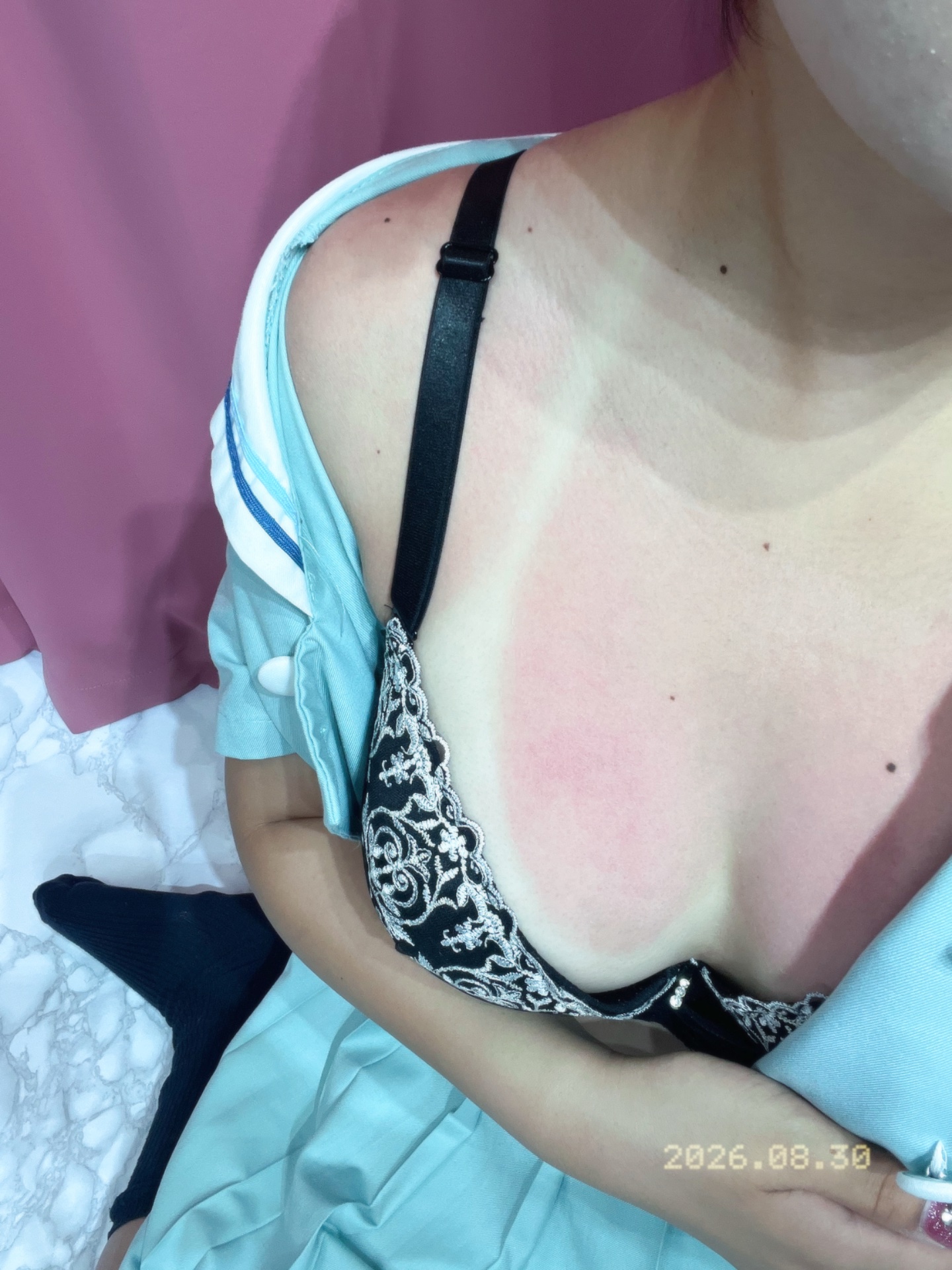 日焼けしちゃった🙈💕